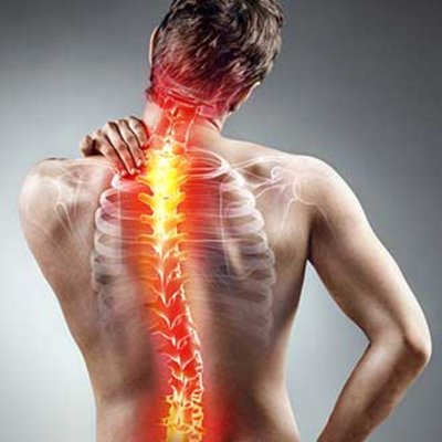 Rückenschmerzen - 1